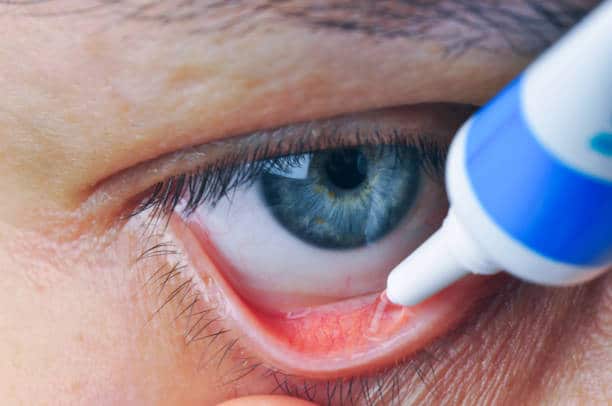 Comment appliquer de la pommade dans l’œil ?